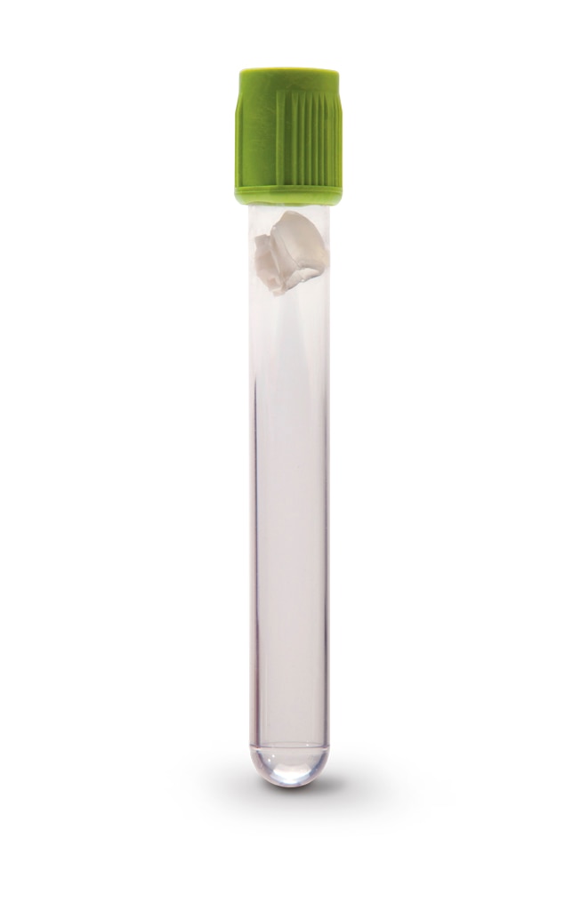 vacutainer-blood-collection