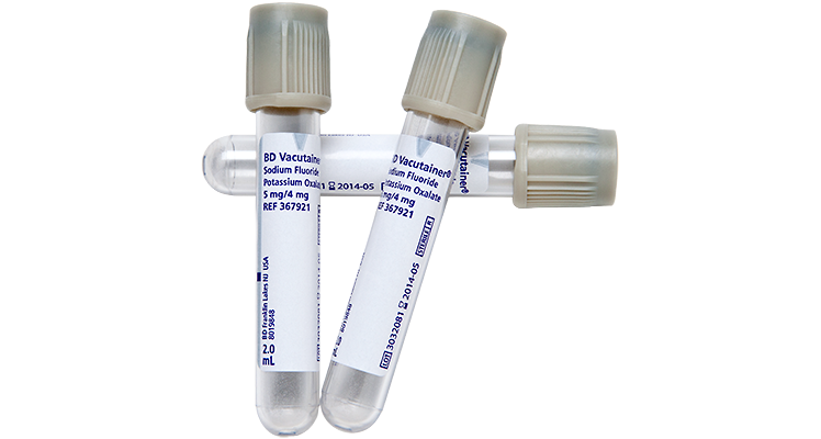 vacutainer-blood-tubes_sodium